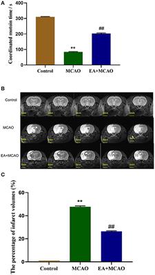 Electroacupuncture Ameliorates Cerebral Ischemic Injury by Inhibiting Ferroptosis